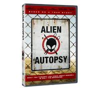Alien Autopsy