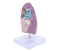 Alipis Vivid Smoking Lung Model Anatomical Pathological Teaching Tool for for Physiology and Anatomy Classes for Students and Healthcare Professionals