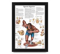 AllStarMedia Human Anatomy - Sports Injuries Poster | Anatomical Posters Educational Chart for Students and Medical Professionals, Wall Art (Unframed A3 (30x40cm))