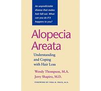 Alopecia Areata: Understanding and Coping with Hair Loss