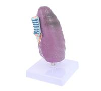 Amosfun Pathological Smoking Lung Model Medical Teaching Anatomy Display Aid for Medical Students Nursing Schools Doctor Patient Communication Educational Tool