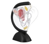 Amosfun Uterus Structure Model, Medical Female Reproductive Organ Model, Uterus Wall Anatomy Teaching Supply for Medical Research and Science Education