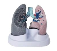 AMULONG Human Anatomy Smoking And Normal Lung Models Human Model Organs Study Tools Organ Study Tools Teaching Models