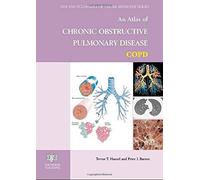 An Atlas of Chronic Obstructive Pulmonary Disease (Encyclopedia of Visual Medicine Series)