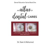 An Atlas of Dental Caries: A Pictorial For Dental Students and Dentists