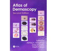 An Atlas of Dermoscopy