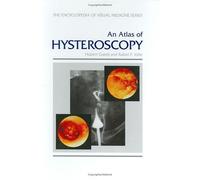 An Atlas of Hysteroscopy (Encyclopedia of Visual Medicine Series)