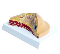 Anatal Disease Cancer Pathological Breast Cross-Section Model for Medical Study