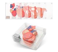Anatomic Heart Specimen Coasters (Set of 6) - 3D Brain Coaster Set also available. Human Anatomy Gifts Medical Student Gifts Regalos para enfermeras Best Gifts For Medical Students. Thinkgeek Coasters