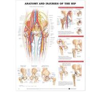 Anatomical Chart Company Anatomy and Injuries of the Hip Anatomical Chart [Parallel Import]
