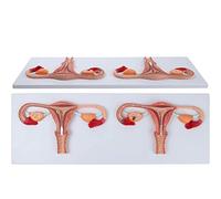 Anatomical Fertilization Process Model, Human Fertilization Process Model, Transverse Models Of Female Reproductive Organs Of Uterus, Ovaries