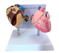Anatomical Heart Model for Health Education and Medical Communication