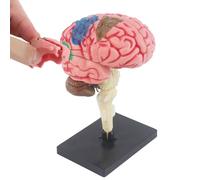 Anatomical Human Brain Model - Science Classroom Display, Color Artery Teaching Head | Removable Educational Anatomy Learning Tool, Medical Brain Training Model for Study Lab School Students