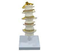 Anatomical Lumbar Spine Model, Human Lumbar Model with 5 Spinal Collars and Spinal Nerves for Detection