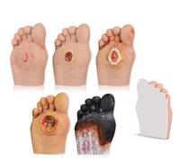 Anatomical Model 5 Pcs Diabetic Foot Care Model Grade 1-5 Diabetic Foot Nursing Simulator Model Human Foot Model for Anatomy Physiology Wound Care Demonstrations Tool