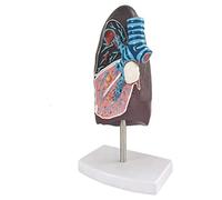 Anatomical Model Assembly Model Anatomy Model Lung Organ Human Pathological Anatomical Respiratory System Model