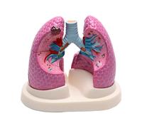 Anatomical Model Comparing Normal and Pathological Lungs for Explanation
