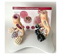 Anatomical model， ModelHealthy Lung and Pathological Comparison ModelClassroom for Doctor Patient Education Anatomical Model