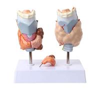 Anatomical Model of Human Thyroid Pathology - The Throat Thyroid Thyroid Cyst Tumor Model, The Human Anatomy Model Medi