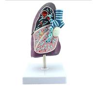 Anatomical model of the human lung Pathological tuberculosis Pneumonia of the smoker for doctor, office, classroom, pati