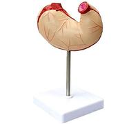 Anatomical Model of The Stomach Science Models of The Human Anatomy Human Digestive System Structure Digestive Organ Model for Training Aid School Teaching Demonstration