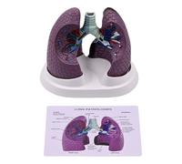 Anatomical Pathological Lung Model Normal and Pathological Lung Anatomy Model for Teaching Research Clinical Settings Health Education Display