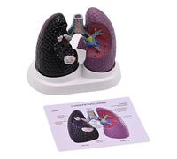 Anatomical Pathological Lung Model Normal and Pathological Lung Anatomy Model for Teaching Research Clinical Settings PVC