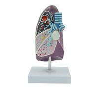 Anatomical Pathological Lung Model Shows Tuberculosis Abscess Smoked for Hospital Lab Model Anatomy Medical Students