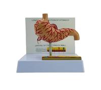 Anatomical Pathological Stomach Model Realistic Human Gastric Perforation Anatomy Teaching Tool for Educational Anatomy