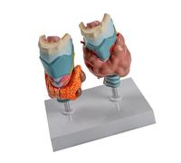 Anatomical Pathological Thyroid Model with Removable Part Pathological Thyroid Larynx Anatomy Model for Educational Use Human Pathology