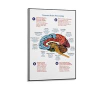 Anatomical Poster Trauma Brain Processing Posters Picture Print Canvas Wall Paint Art Decor Modern Home 16x24inch(40x60cm)