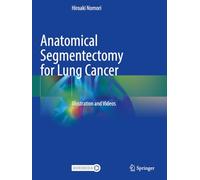 Anatomical Segmentectomy for Lung Cancer: Illustration and Videos