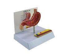 Anatomical Stomach Perforation Model Pathological Gastric Anatomy Model for Teaching Demonstration and Educational Surgical Training Equipment