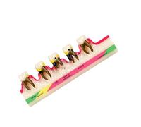 Anatomical Teeth and Gingiva Model Color Coded Life Size Periodontitis Anatomy Model Teaching Aid for Clinical Setting Adult Periodontal Demonstration