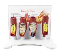anatomy, Human Heart and Brain Blood Vessel Blockage Model- Body Stent Anatomical Model - For Educational Training Aid
