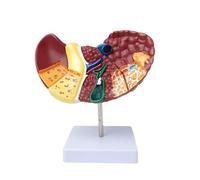 Anatomy Liver Model Human with Base and Clear Texture and Pathological Features Liver Cancer Model for Teaching Display Study Supplies Life Size