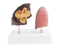 Anatomy model Anatomy Model, Pathological Lung Healthy Lungs Comparative Model Organ Cut Section Anatomy with Instructions, 1:1 Lung and Normal Lung Comparison Model