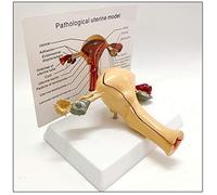Anatomy model Human Anatomy Model, Uterus & Ovary Model, Female Reproductive Organ, Anatomical Anatomy Disease Pathology, Medical Lesion for Teaching Learning Tool