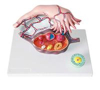Anatomy model Uterine Anatomy Model - 3 Parts Female Ovaries Anatomy Model Genitourinary System - for Medical Gynecology Aid