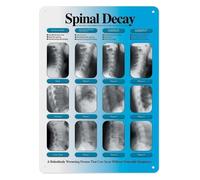 Anatomy of The Spine Aluminum Sign Human Backbone Diagram Chiropractic Office Decor Student Gift Physical Wall-Art Poster 8 X 12 Inch