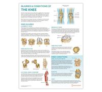 Anatomy Stuff Injuries and Conditions of the Knee Poster, 45x60 cm, 18x24 inches, Physio Diagram, Sports Medicine Wall Chart