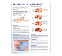 Anatomy Stuff Pressure Ulcer Assessment & Care Charter/Poster, 45x60cm, 18x24 inches, Clinical Skills Guide, Nurse Poster, Pressure Ulcers