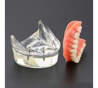 Anatomy Teeth Model Dental Teeth Model - Teeth Study Teaching Demonstration Model - Dental Care Model - Adult Standard Orthodontic Oral Tooth Demonstration Model