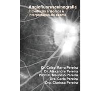 Angiofluoresceinografia : Introducao a Interpretacao do Exame