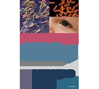 Aniridia and WAGR Syndrome: A Guide for Patients and Their Families
