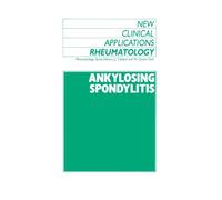 Ankylosing Spondylitis
