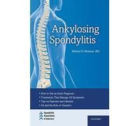 Ankylosing Spondylitis