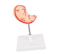 Anneome Realistic Human Stomach Model for Detailed Gastric Anatomy Teaching Tool with User Friendly Assembly Stomach Learning Model for Classroom and Clinical Use
