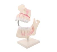 Anneome Realistic Typodont Model for Training High Simulation Plastic Tooth Model with Detailed Morphology Stable Oral Care Educational Tool for Exam Preparation and Teaching