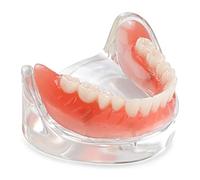 ANNWAH Dental Overdenture Inferior Model - Locator Denture Model with 4 Implants Implant Locator Model Teaching Study Teeth Model